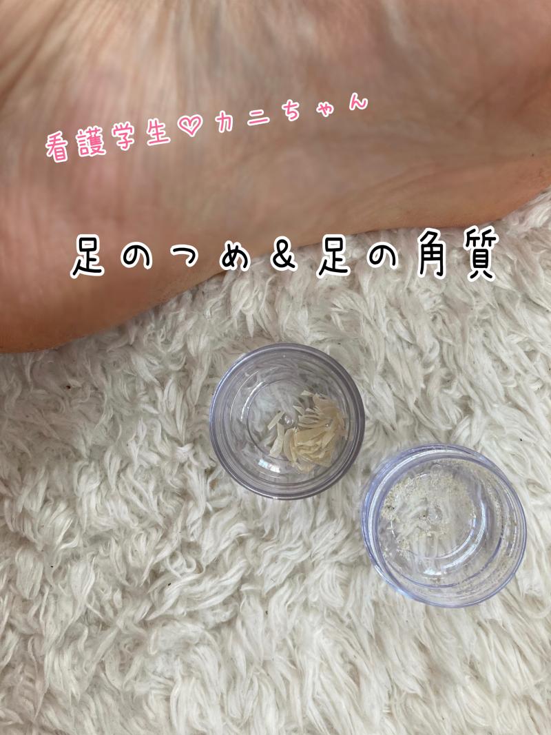 看護学生の足のつめと角質