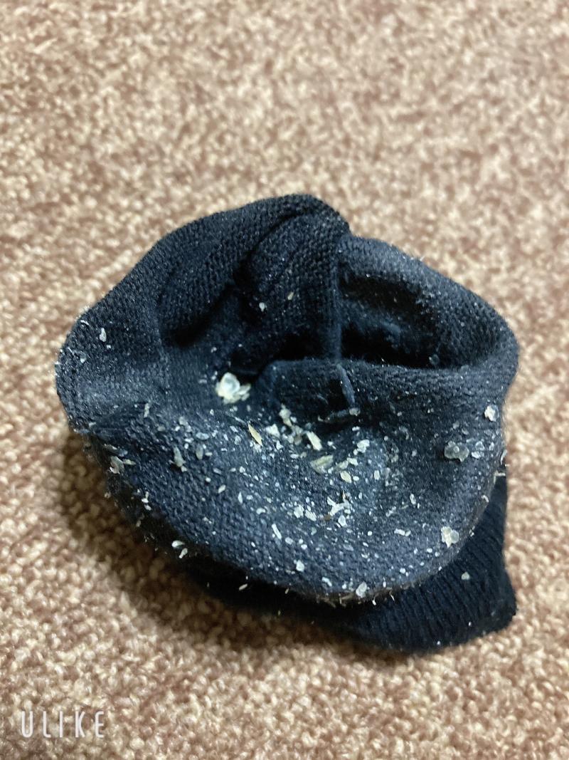 風呂無し❤︎.*10日連バキの足垢カスたっぷりのクッサくさのソックスᥫᩣ  ̖́-
