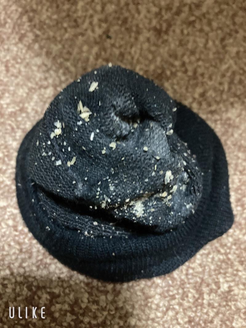 足カスたっぷりの10日連履きのクッサくさのくつ下ᰔᩚᰔᩚᰔᩚ