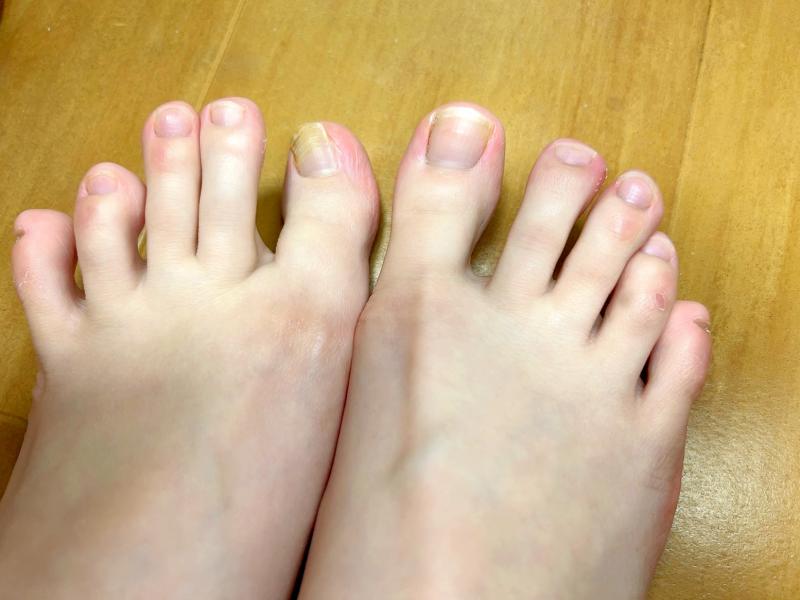 レア!?変色爪込み☆受付嬢百里菜の足の爪♡