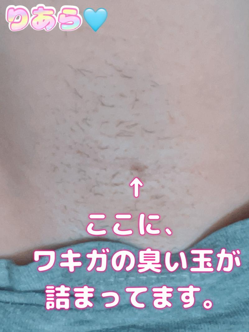 半年から1年に1回くらいしか取れない、ワキガの臭い玉