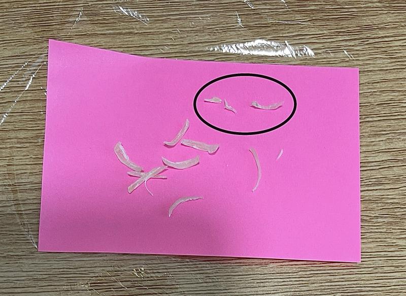 腐ったヨーグルトみたいな匂いの足垢付き爪