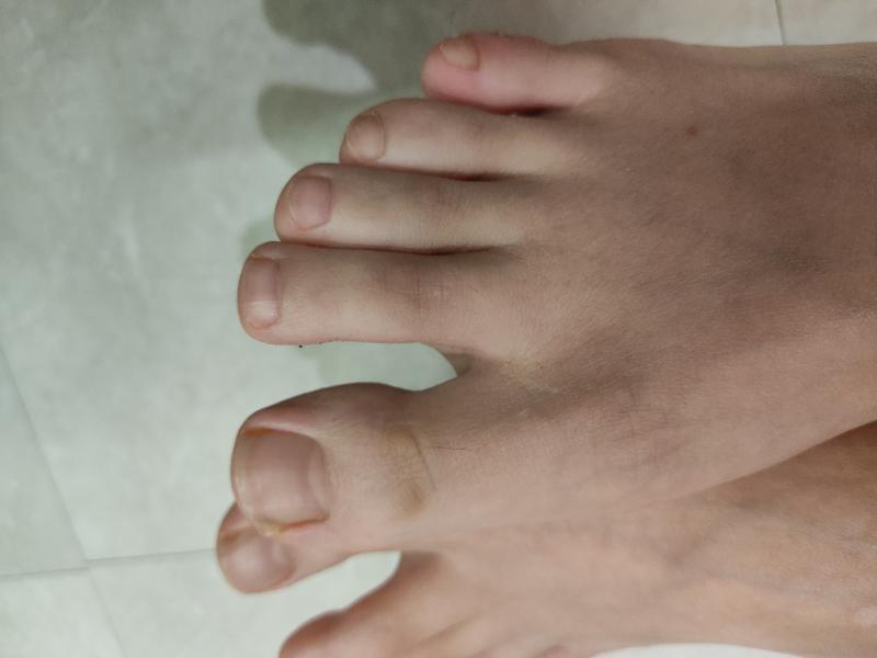 ３月の足の爪