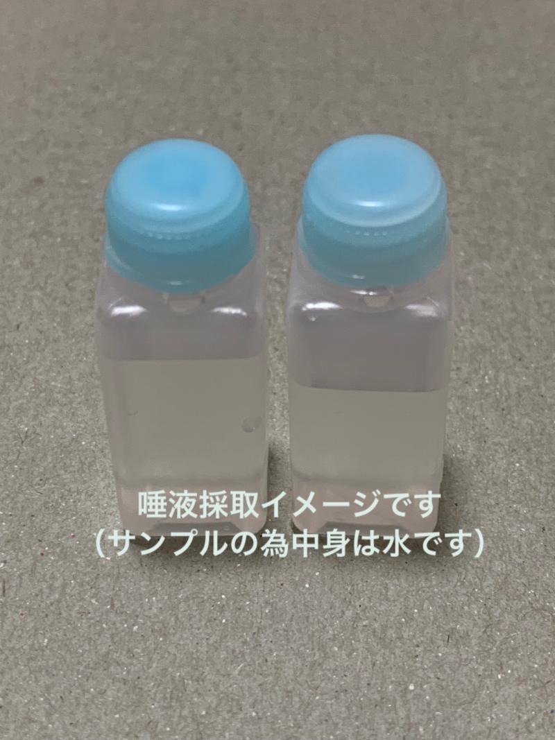 歯磨き前の汚い唾液ボトル２つ分