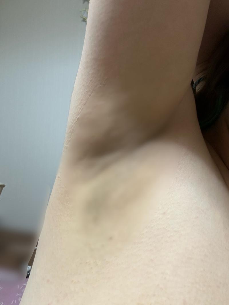 ワキガさんの汗脇パッド３日分♡6枚