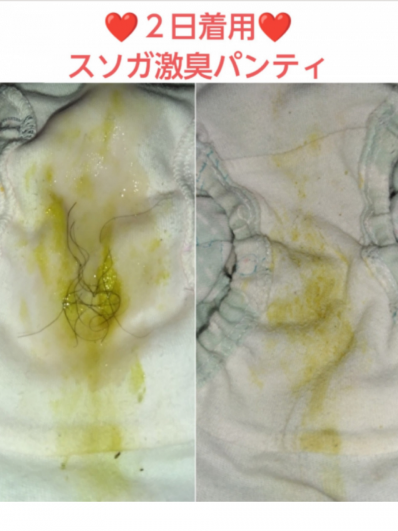 オナ&陰毛無料♥スソガ♥2日着用激臭パンティ