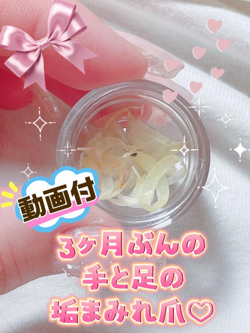 【動画付】垢まみれ♡3ヶ月分の手足の爪♡