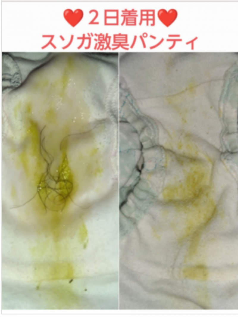 オナ&陰毛無料♥スソガ♥2日着用激臭パンティ