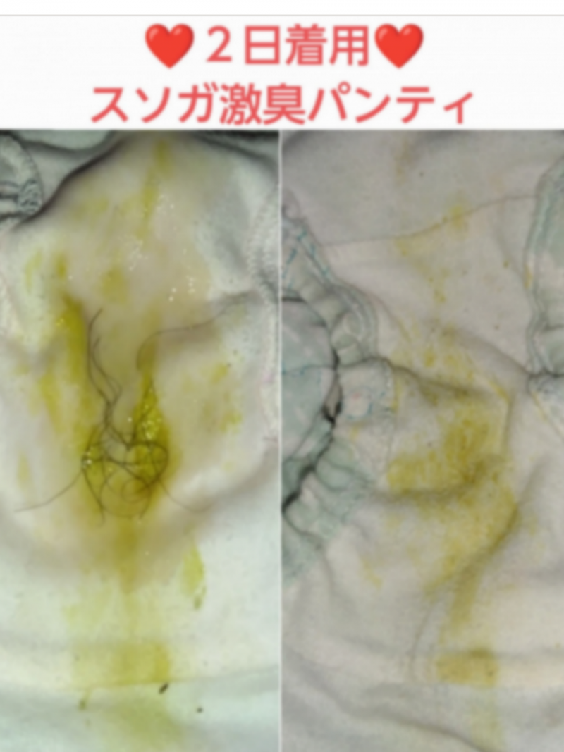 オナ&陰毛無料♥スソガ♥2日着用激臭パンティ