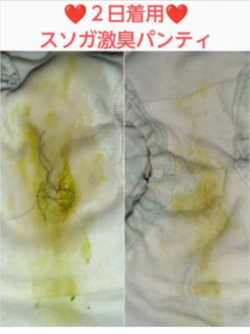 オナ&陰毛無料♥スソガ♥2日着用激臭パンティ