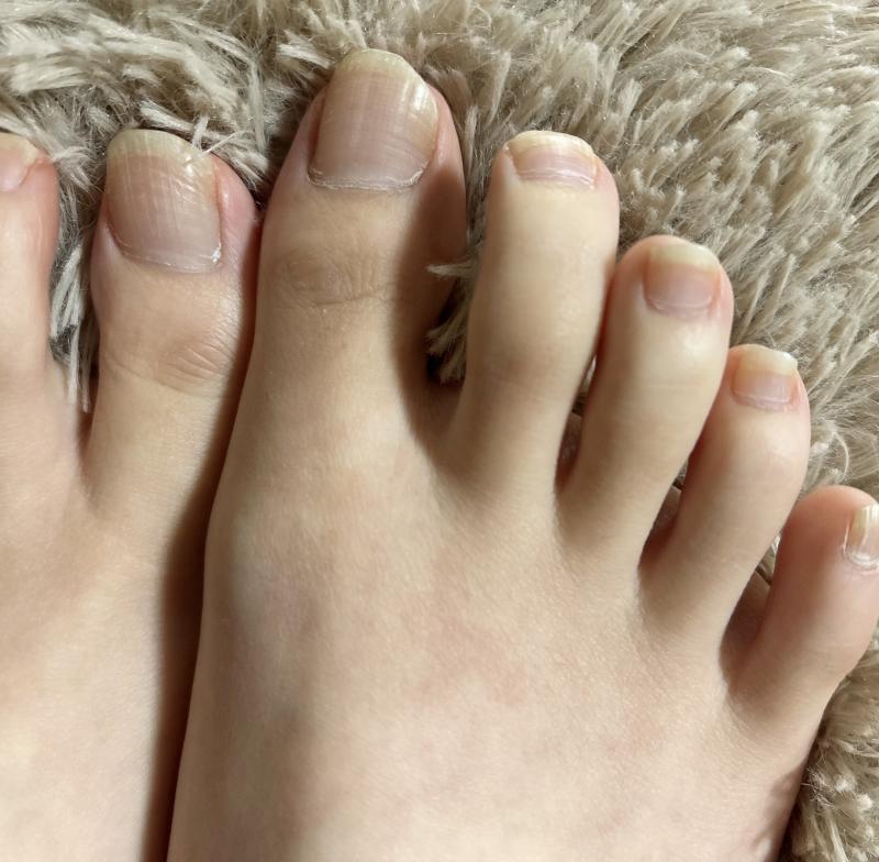 注文が入ったら切ります！伸びきった足の爪♡