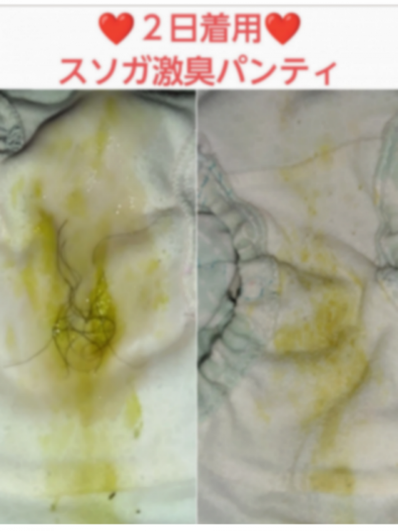 オナ&陰毛無料♥スソガ♥2日着用激臭パンティ