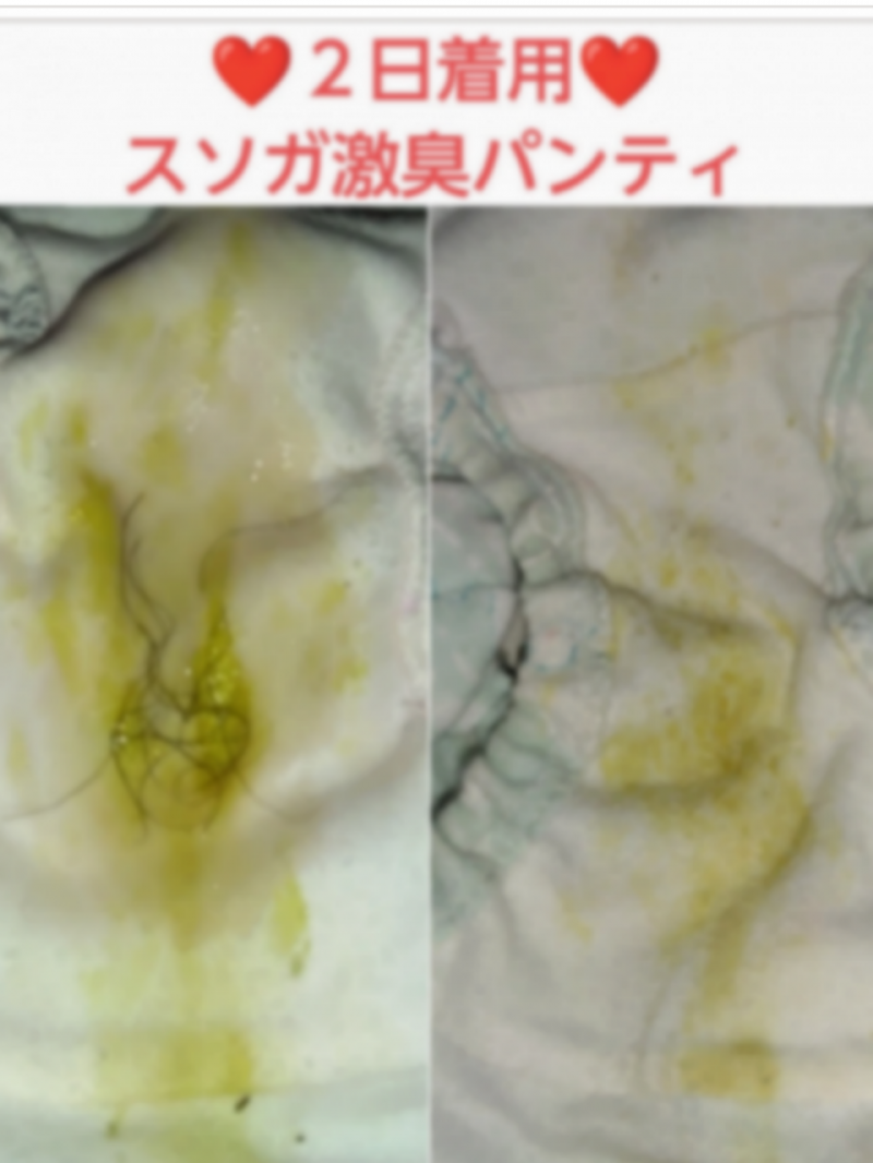 オナ&陰毛無料♥スソガ♥2日着用激臭パンティ