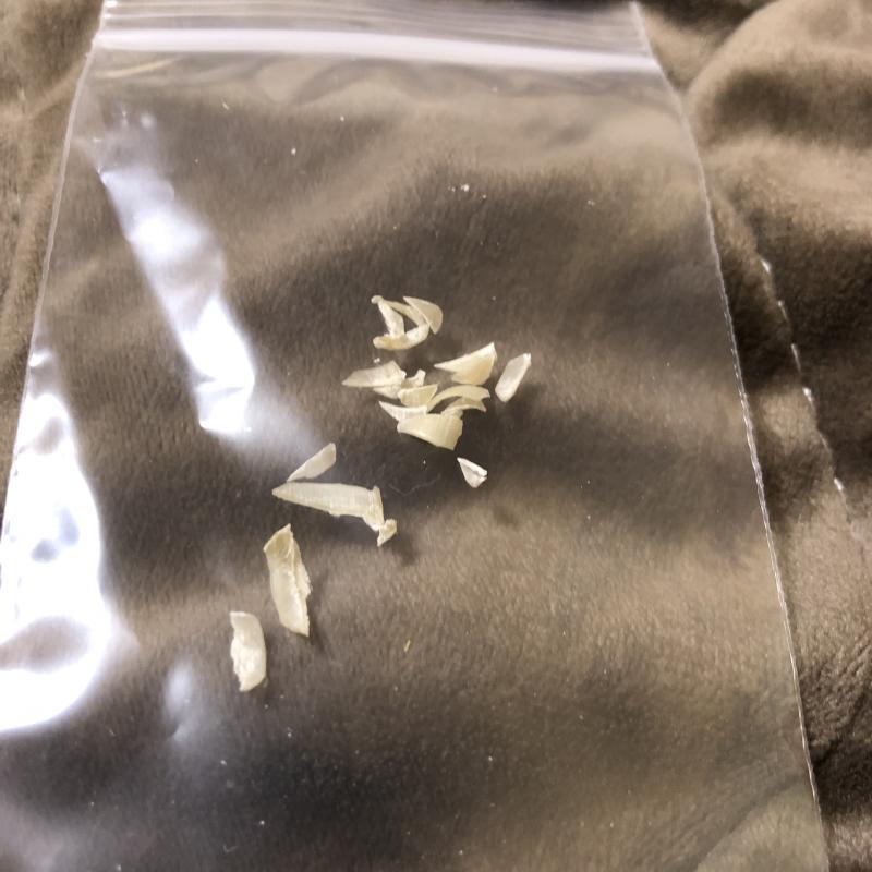 初出品♡半年間切らずに生活して切った足爪全部♡1日着用靴下セット
