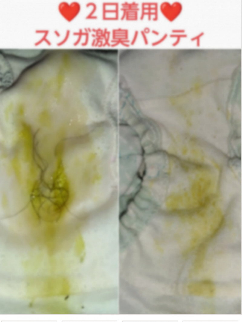 オナ&陰毛無料♥スソガ♥2日着用激臭パンティ