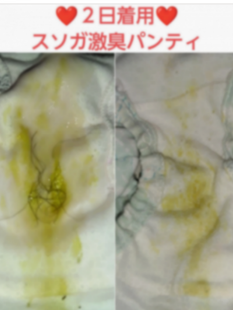 オナ&陰毛無料♥スソガ♥2日着用激臭パンティ