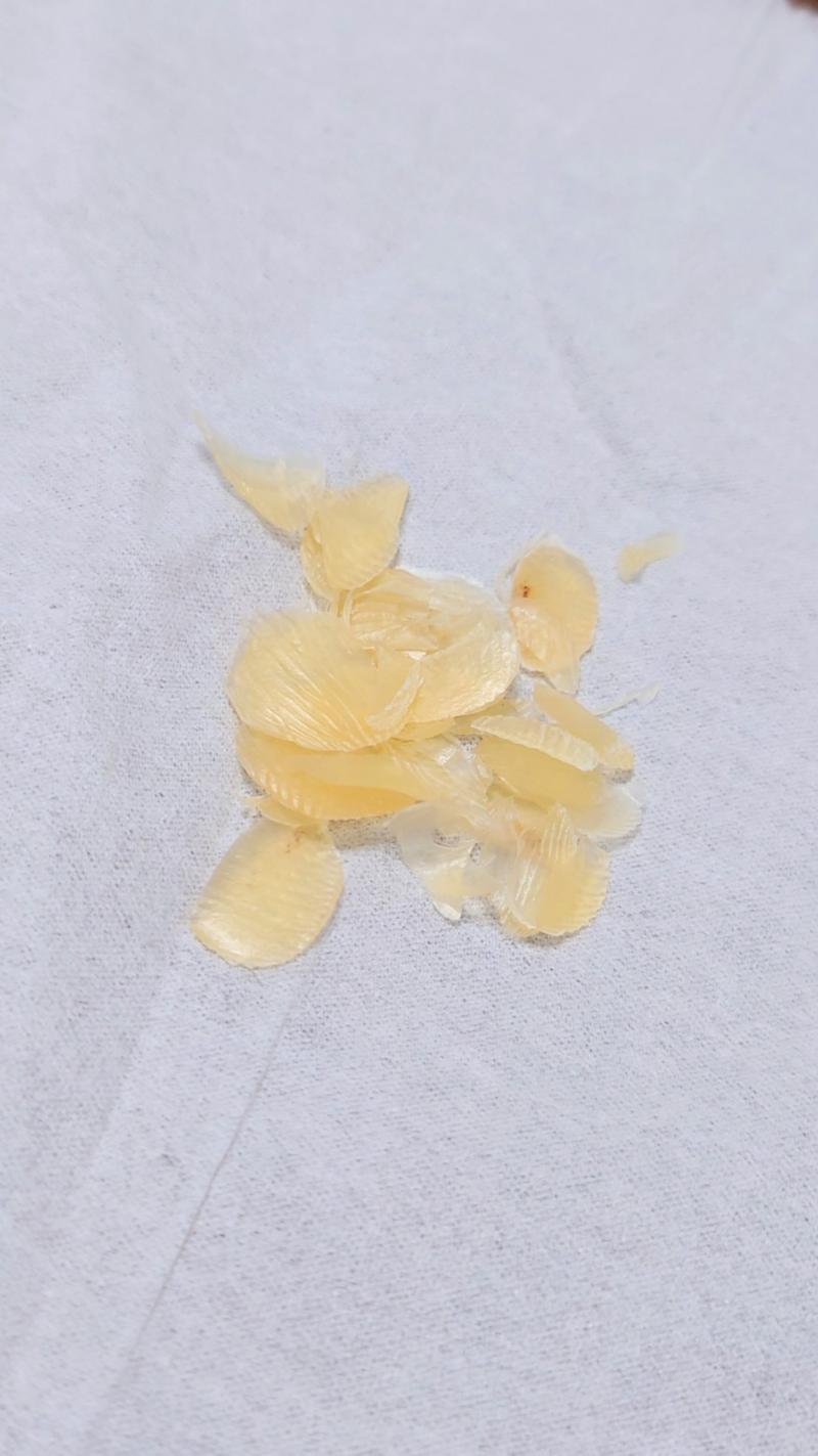 何ヶ月も溜め込んだ両足の分厚い皮(*´∀｀*)