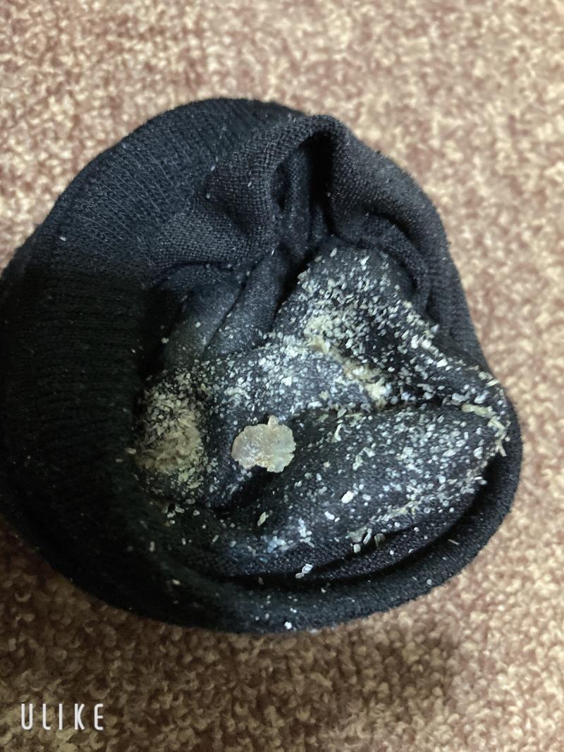 風呂無し★2週間連履きの足垢カスたっぷりのクッサくさのくつ下