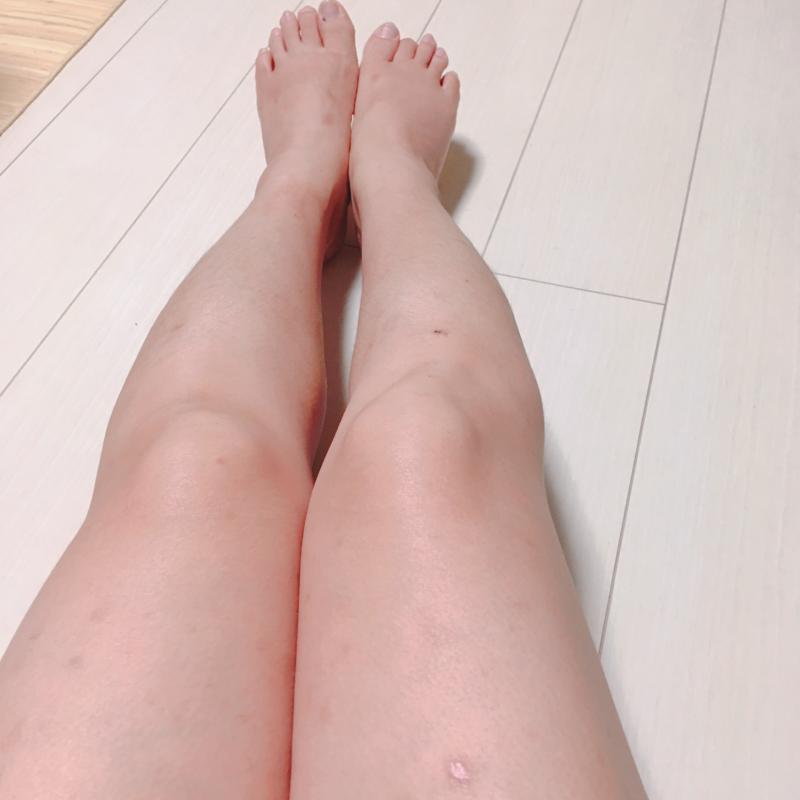 みー